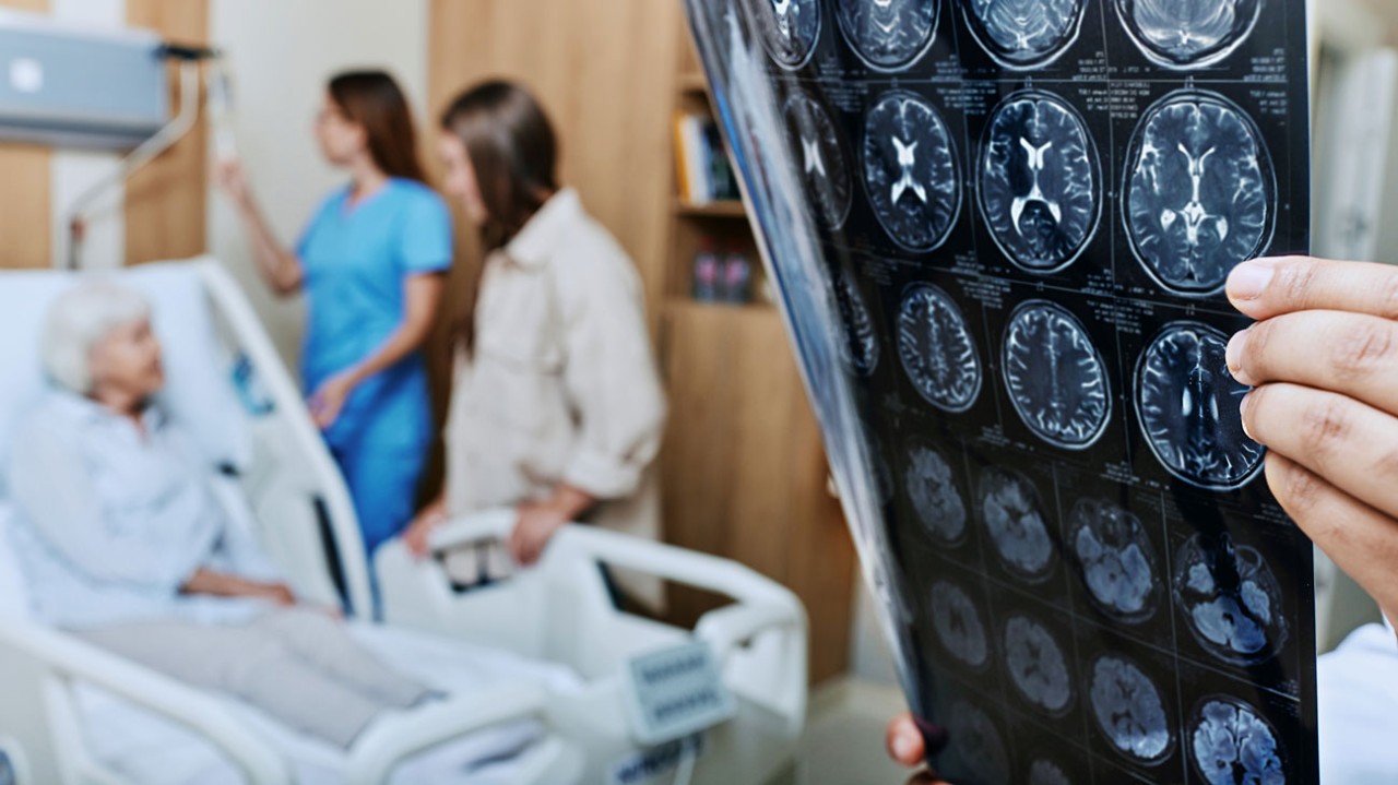 MRI of head of elderly woman in hands of doctor standing in medical ward near senior patient with relative and nurse. Recovery after a stroke